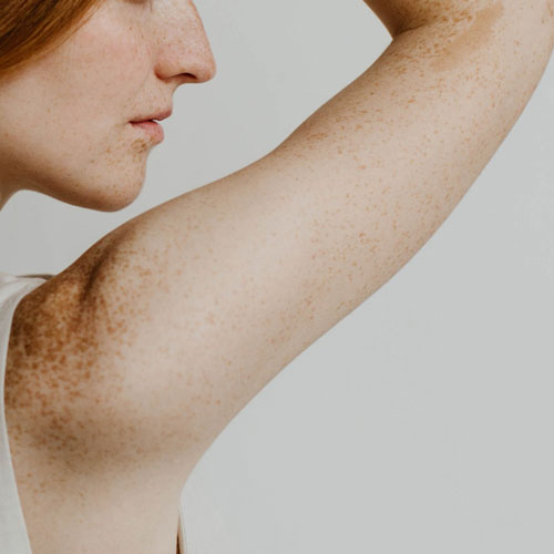 Skin rejuvenation — Skin Aging